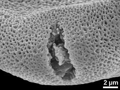 acetolyzed pollen,aperture