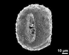 dry pollen grain in equatorial view