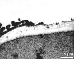 pollen wall at transition of aperture and interapertural area