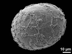 distal polar view