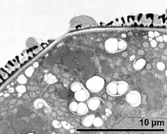 pollen wall; aperture area