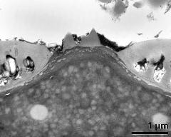 apertural area of pollen wall