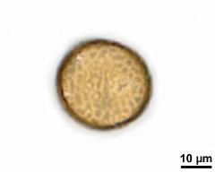 acetolysed pollen, lower focus