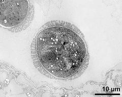 pollen grain in cross section