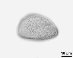 pollen grain after acetolysis