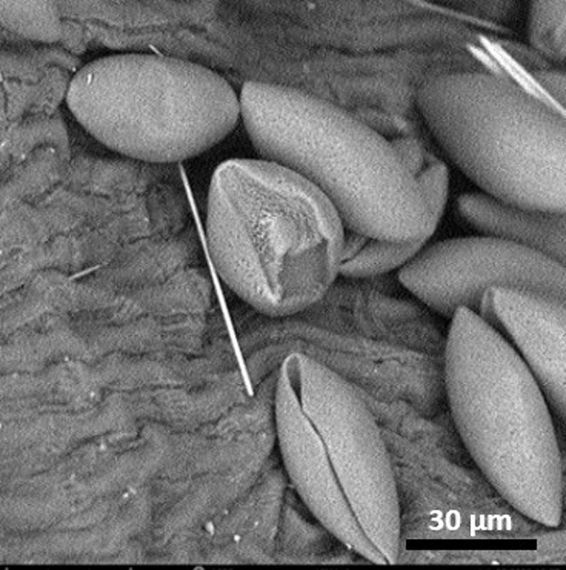 dry pollen,equatorial view,polar area