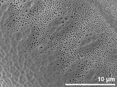 exine surface