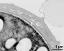 interapertural area of pollen wall, intine (I), endexine (E)