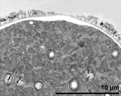 pollen wall; aperture area