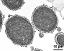 cross section of pollen grains