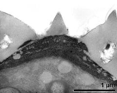 apertural area of pollen wall