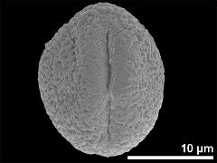 Equatorial view showing one aperture