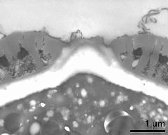 apertural area of pollen wall