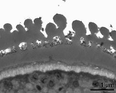 interapertural area of pollen wall