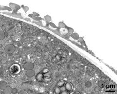 pollen wall at transition of aperture and interapertural area