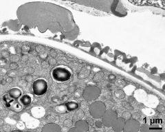 pollen wall and pollenkitt in loculus