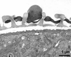 pollen wall; interapertural area