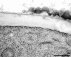 pollen wall at transition of aperture and interapertural area