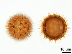 acetolyzed pollen,equatorial view