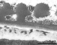 pollen wall at transition of aperture and interapertural area