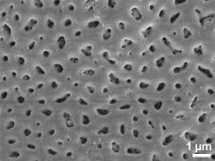 acetolyzed pollen,exine surface