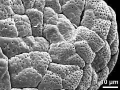 tetrads (forming massula)