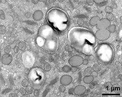 vegetative cytoplasm with organells