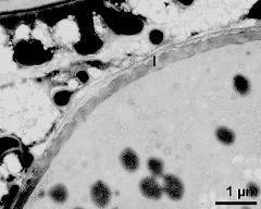 apertural area of pollen wall, intine (I)