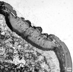 aperture in cross section