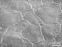 tetrads (forming pollinium)