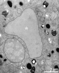 generative cell and vegetative nucleus (asterisk)