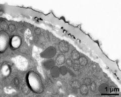 pollen wall, interapertural area