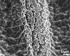 detail of aperture of dry pollen grain