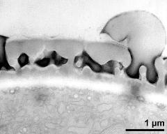 interapertural area of pollen wall