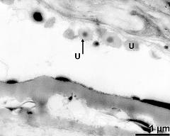 pollen wall (bottom) and tapetum cells with Ubisch bodies (U)