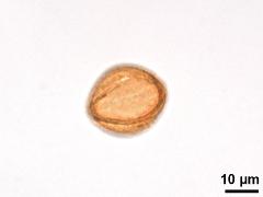 equatorial view,acetolyzed pollen