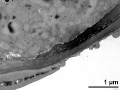 pollen wall, transition from aperture to interapertural area