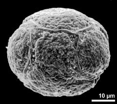 interapertural area of pollen grain