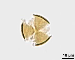 acetolyzed pollen,polar view,lower focus