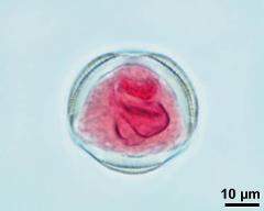 pollen grain with vegetative nucleus and sperm cells