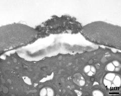 apertural area of pollen wall