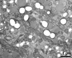 cytoplasm with organells, note stacked endoplasmic reticulum