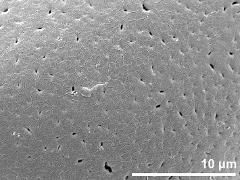exine surface