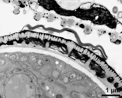 pollen wall, interapertural area, pollenkitt and Ubisch bodies on inner anther wall