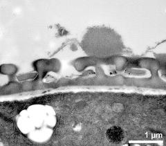 interapertural area of pollen wall