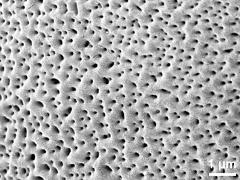 exine surface