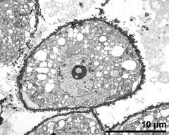 cross section of pollen grain