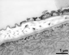 pollen wall at transition of aperture and interapertural area