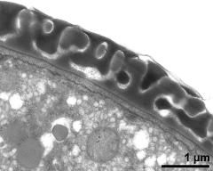 pollen wall, interapertural area