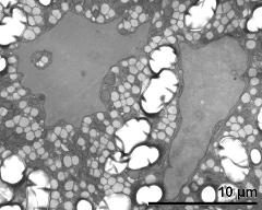 vegetative nucleus (right) and sperm cell